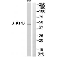 Rabbit Polyclonal Antibody to STK17B