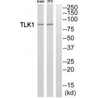 Rabbit Polyclonal Antibody to TLK1