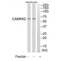 Rabbit Polyclonal Antibody to CAMKK2