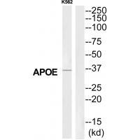Rabbit Polyclonal Antibody to APOE
