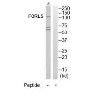 Rabbit Polyclonal Antibody to FCRL5