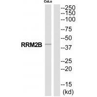 Rabbit Polyclonal Antibody to RRM2B