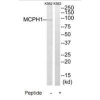 Rabbit Polyclonal Antibody to MCPH1
