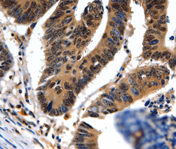 Rabbit Polyclonal Antibody to NEFL
