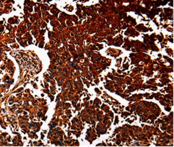 Rabbit Polyclonal Antibody to ANXA7