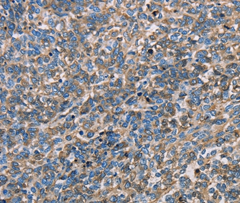 Rabbit Polyclonal Antibody to APOA1