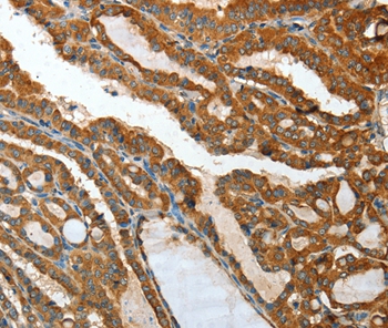 Rabbit Polyclonal Antibody to IL12RB1