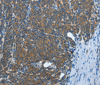 Rabbit Polyclonal Antibody to IL13RA2