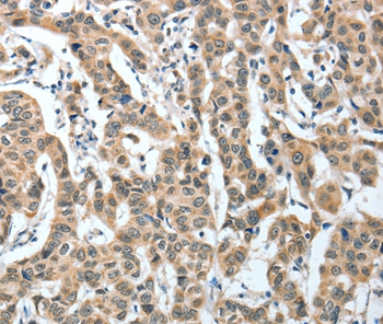 Rabbit Polyclonal Antibody to IL1R1