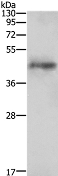 Rabbit Polyclonal Antibody to AGTR1