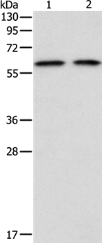 Rabbit Polyclonal Antibody to ADAM2