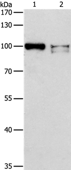 Rabbit Polyclonal Antibody to ADAMTSL2