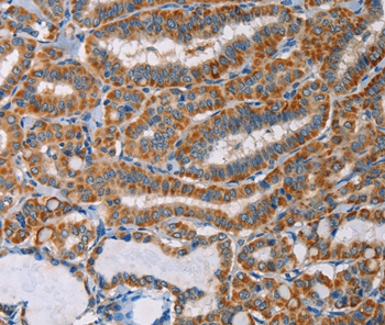 Rabbit Polyclonal Antibody to AGPAT4