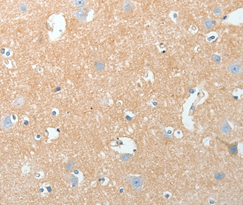 Rabbit Polyclonal Antibody to AKAP7