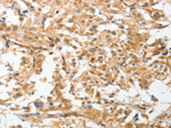 Rabbit Polyclonal Antibody to ANGPTL7