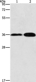 Rabbit Polyclonal Antibody to ANXA9