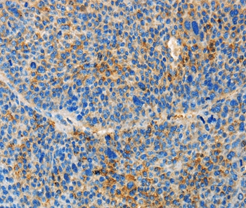 Rabbit Polyclonal Antibody to TNFSF13