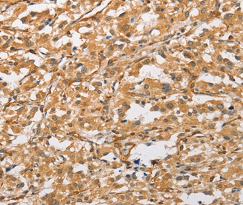 Rabbit Polyclonal Antibody to ARMCX1