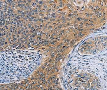 Rabbit Polyclonal Antibody to ORMDL3