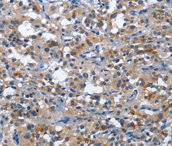 Rabbit Polyclonal Antibody to CD177
