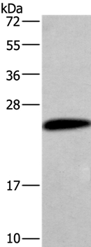 Rabbit Polyclonal Antibody to CGB