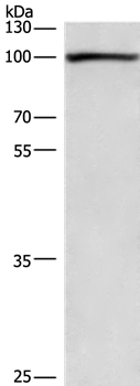Rabbit Polyclonal Antibody to PLA2G4A