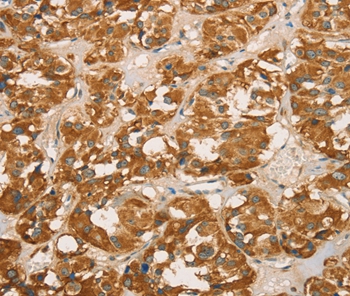Rabbit Polyclonal Antibody to RBBP8