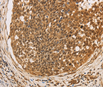 Rabbit Polyclonal Antibody to CXXC5