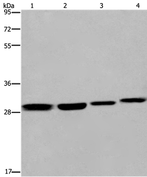 Rabbit Polyclonal Antibody to ETV7