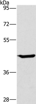 Rabbit Polyclonal Antibody to GCK