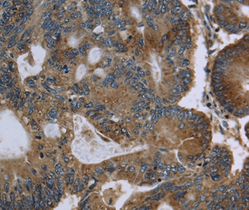 Rabbit Polyclonal Antibody to GK