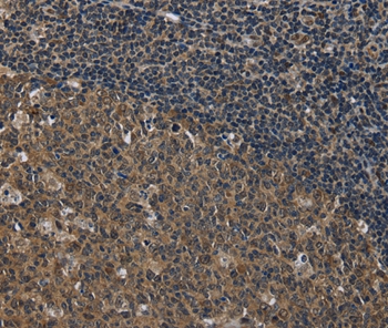 Rabbit Polyclonal Antibody to SETD7