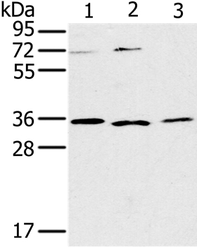 Rabbit Polyclonal Antibody to IL22RA2