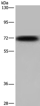 Rabbit Polyclonal Antibody to KCND3