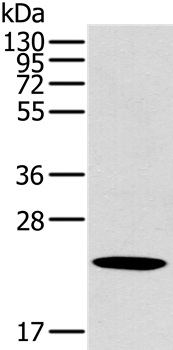 Rabbit Polyclonal Antibody to OTUB2