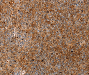 Rabbit Polyclonal Antibody to SERPINB2