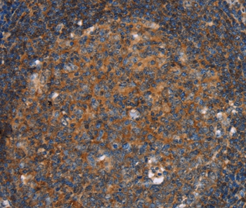 Rabbit Polyclonal Antibody to PFKL