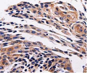 Rabbit Polyclonal Antibody to ADRB1