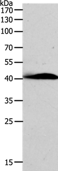 Rabbit Polyclonal Antibody to AD7C-NTP