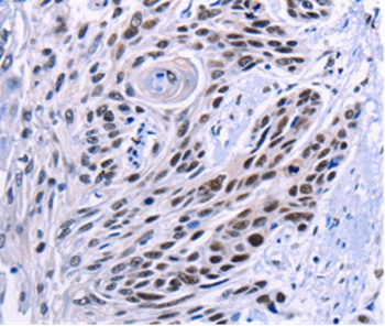 Rabbit Polyclonal Antibody to CREBBP