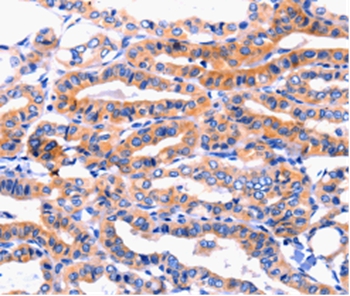 Rabbit Polyclonal Antibody to CFTR