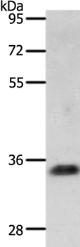 Rabbit Polyclonal Antibody to JUND