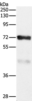 Rabbit Polyclonal Antibody to CPT2