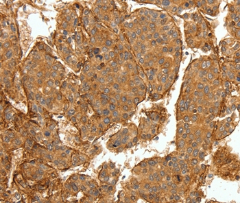 Rabbit Polyclonal Antibody to COL4A1