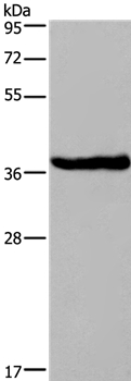 Rabbit Polyclonal Antibody to DUSP1