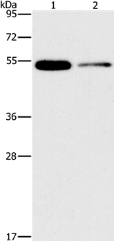 Rabbit Polyclonal Antibody to FOXF2