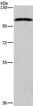 Rabbit Polyclonal Antibody to ANO1