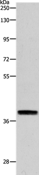 Rabbit Polyclonal Antibody to RTN4