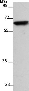 Rabbit Polyclonal Antibody to SLC22A8