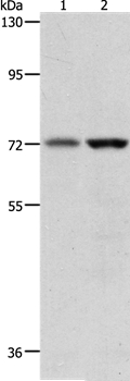 Rabbit Polyclonal Antibody to PGR